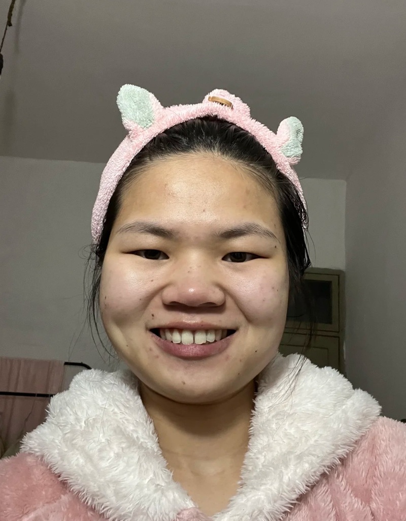 ảnh gái xấu cười tươi với băng đô tai thỏ dễ thương